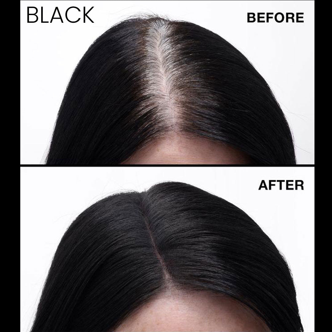 Never Miss Root & Scalp Spray