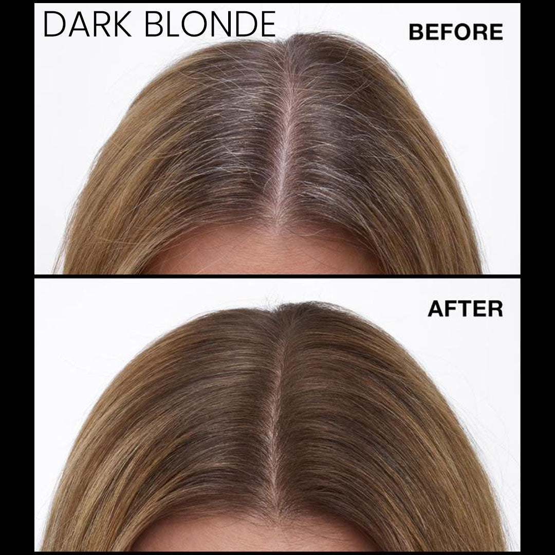 Never Miss Root & Scalp Spray