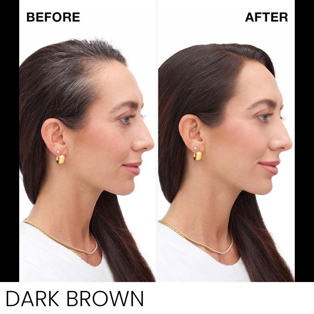 Never Miss Root & Scalp Spray