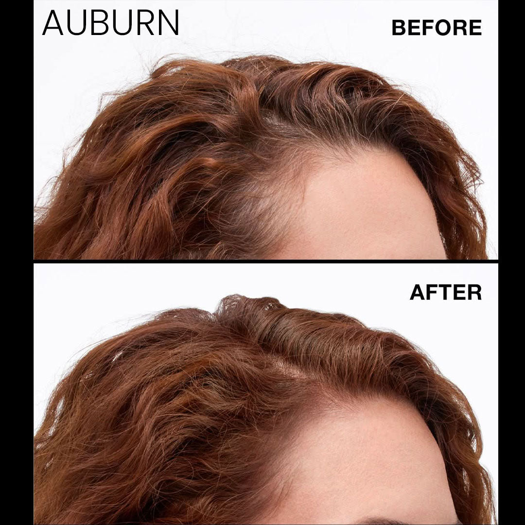 Never Miss Root & Scalp Spray