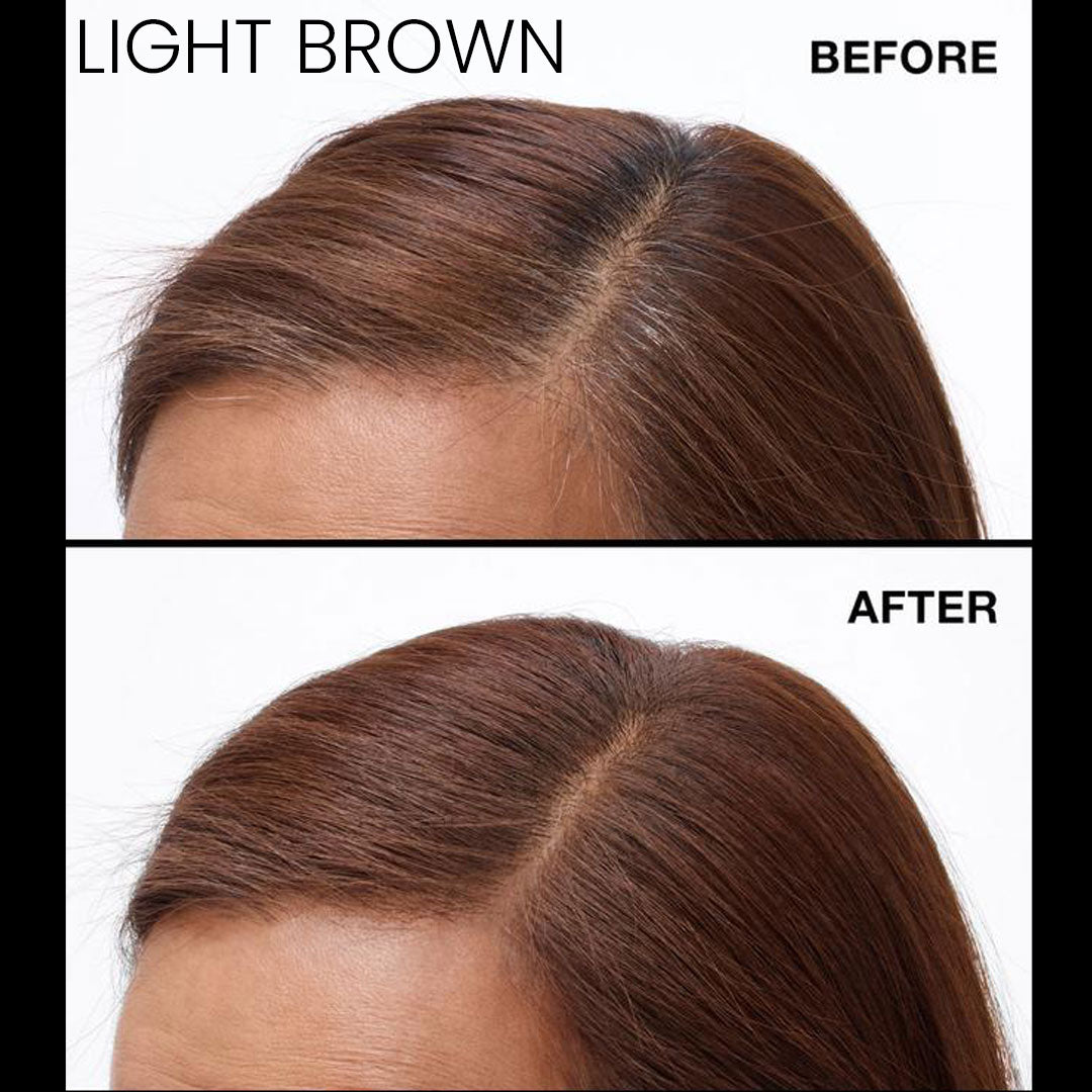 Never Miss Root & Scalp Spray