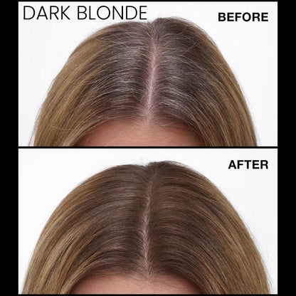 Never Miss Root & Scalp Spray