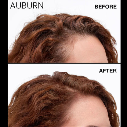 Never Miss Root & Scalp Spray